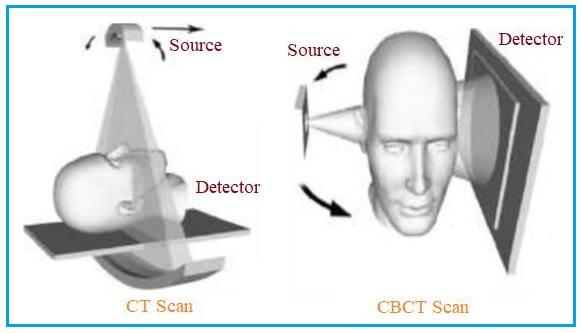 CT scanner vs CBCT scanner