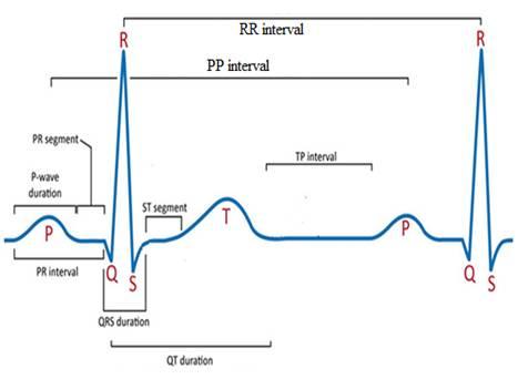 ECG curve