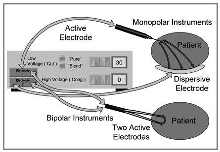 Monopolar Electrosurgery vs Bipolar Electrosurgery