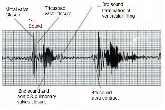 PCG signal