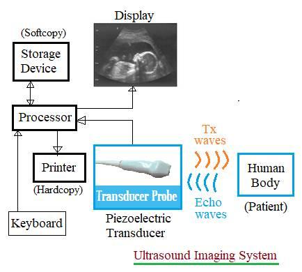 Ultrasound imaging system block diagram