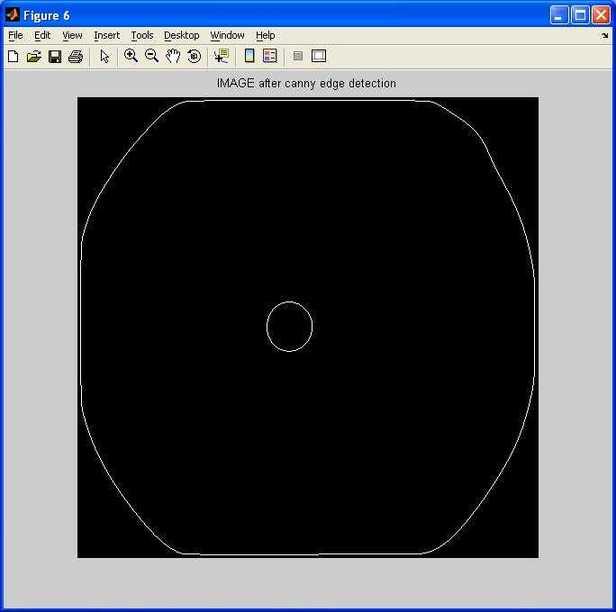 iris detection after canny detection