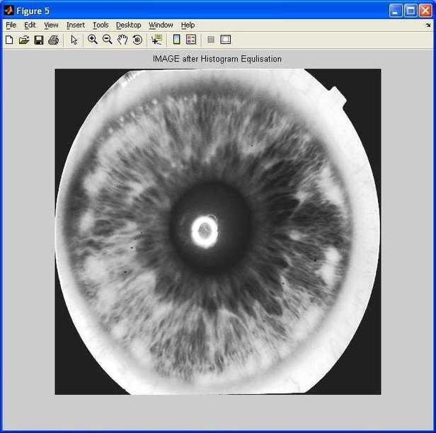 iris detection histogram equalization