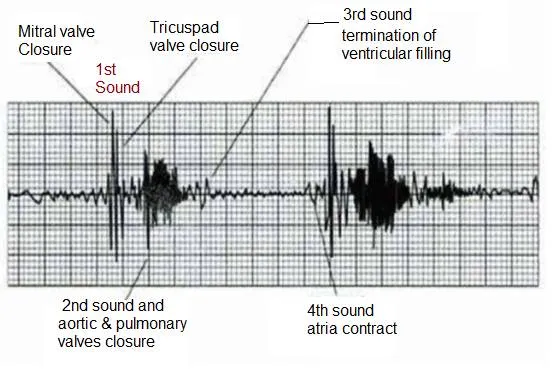 PCG signal
