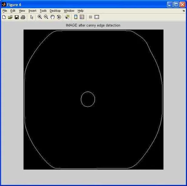 iris detection after canny detection