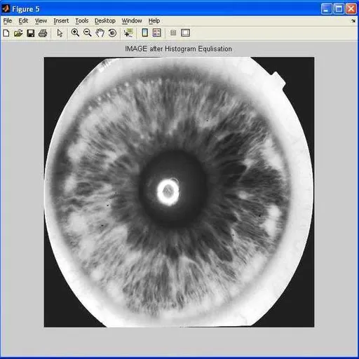 Iris Detection and Recognition: MATLAB Code