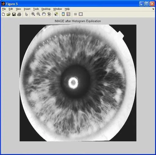 iris detection histogram equalization