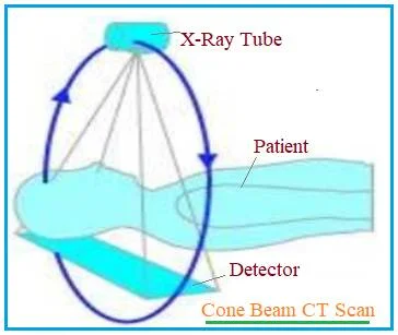 Cone Beam Computed Tomography for CBCT scanning